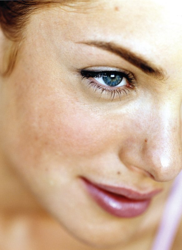 tretmani laserom, žena ljepota