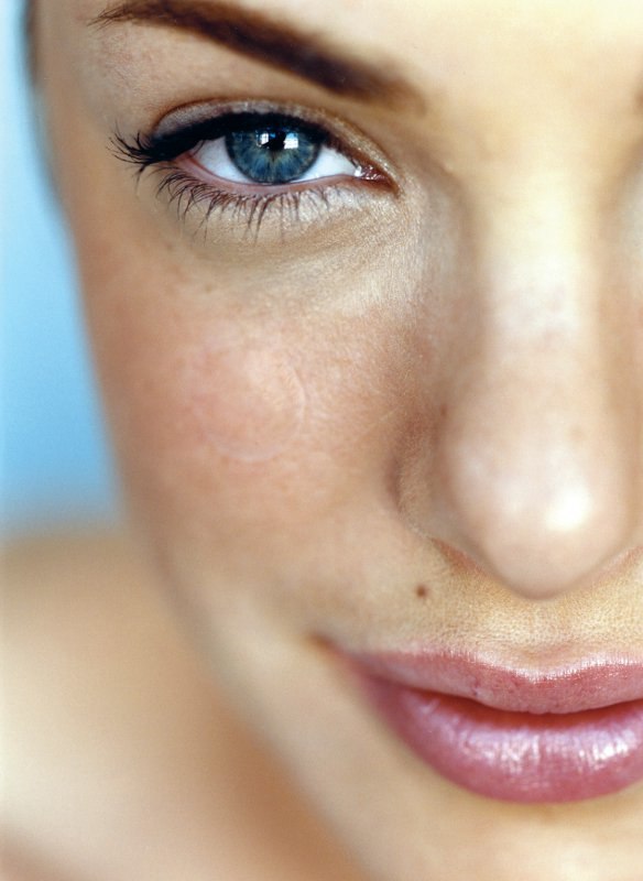 tretmani laserom, žena ljepota