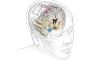 mozak, implantat u mozgu, implantat, depresija