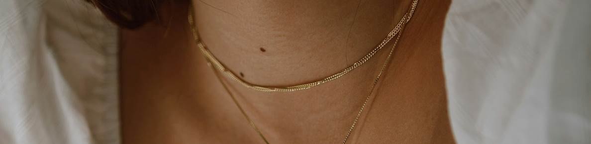 Imate li pigmentacijske promjene posebnog oblika?